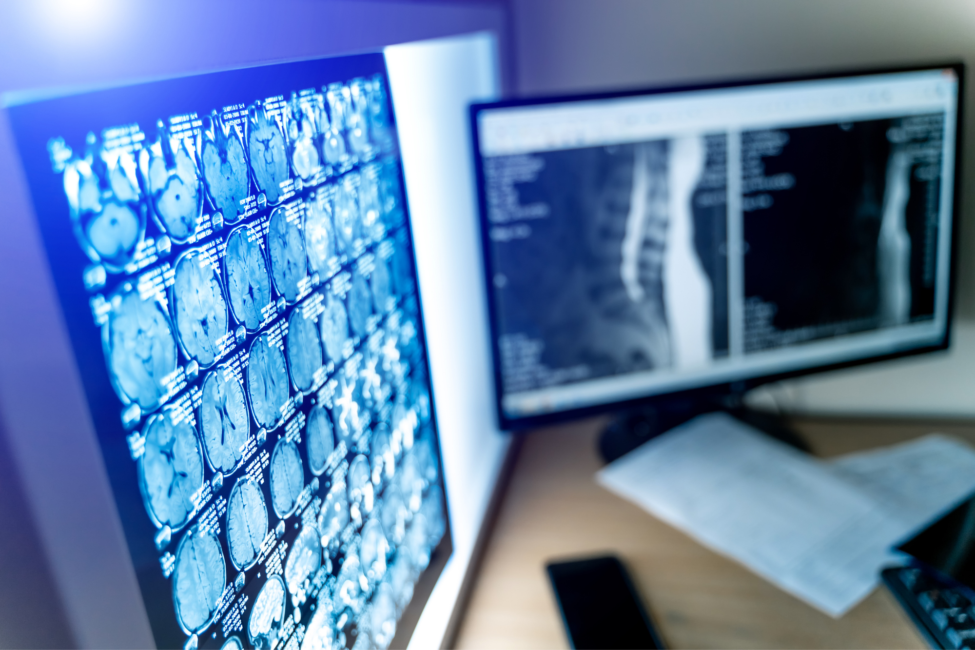 Lovelace – Advanced Imaging 2000×1333